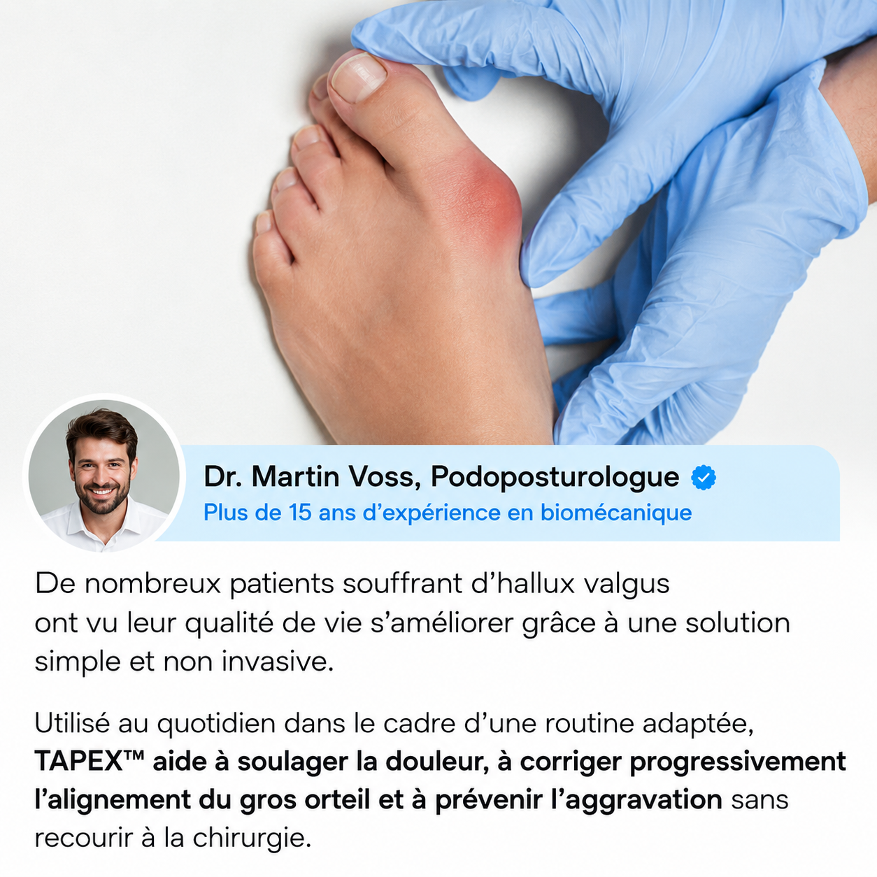TAPEX™ - Correcteur Hallux Valgus