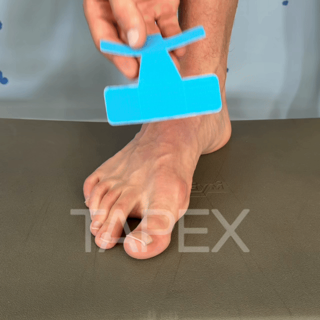 TAPEX™ - Correcteur Hallux Valgus
