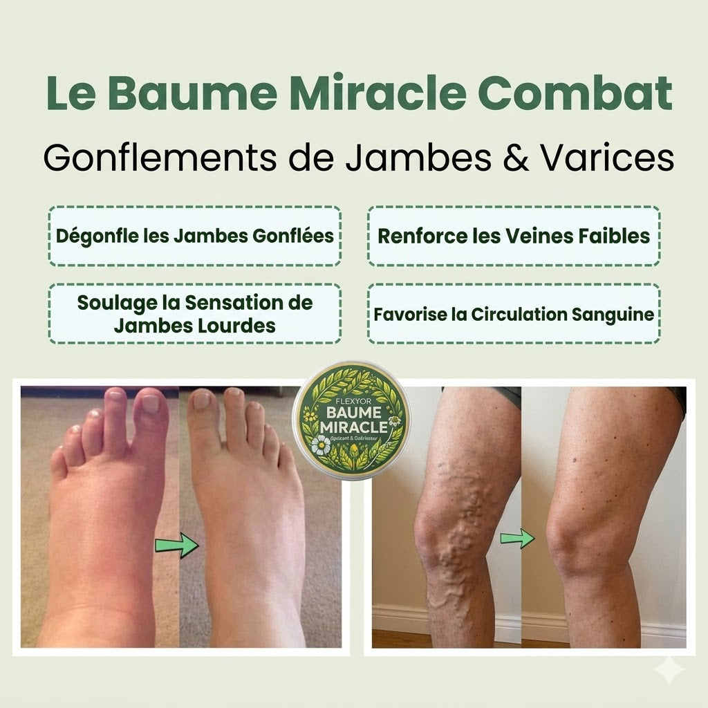 Flexyor™ Miracle Balm