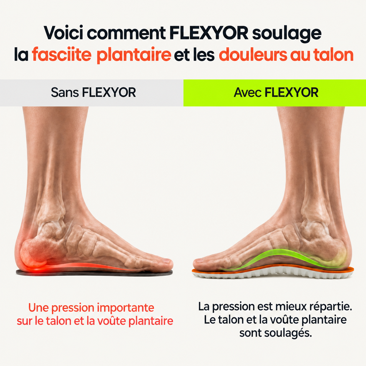 Comment FLEXYOR répartit la pression sous le pied