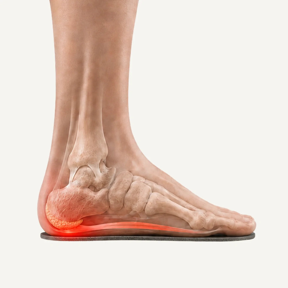 Pied sans semelle : pression concentrée sur le talon